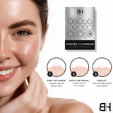 Benny Hancock SKIN 72 x Acne Pimple Patches - McGrocer