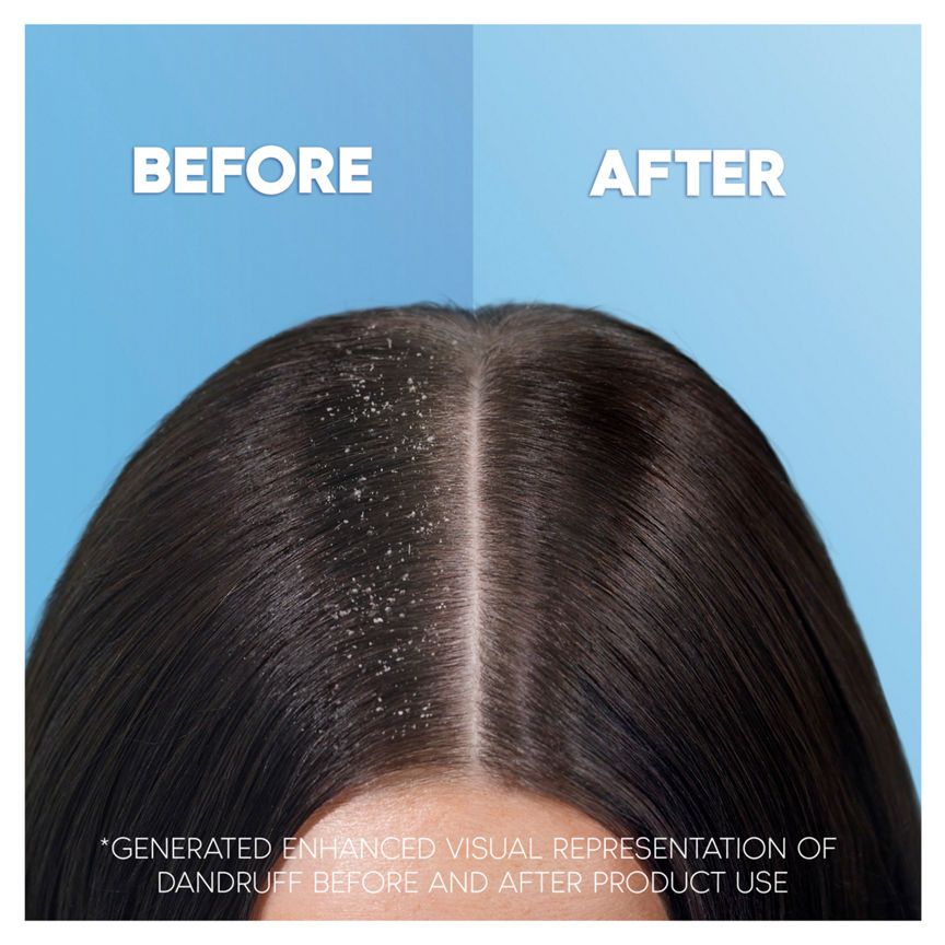 Head & Shoulders Anti Dandruff Shampoo Deep Hydration with Coconut Oil